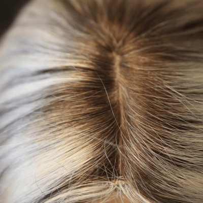 European Human Hair Topper | Platinum Blonde Ash Brown Roots and Lowlights + Free Gift